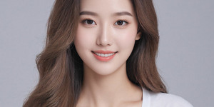 Nasolabial Fold Filler [Restylane]